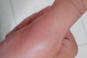 篮球比赛中手指与防守人的碰撞（探索篮球比赛中手指受伤的原因及防范措施）