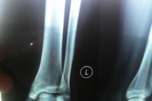 中枢脚还是活动脚，篮球防守的关键（掌握节奏，守住中枢脚；灵活应对，追击活动脚）